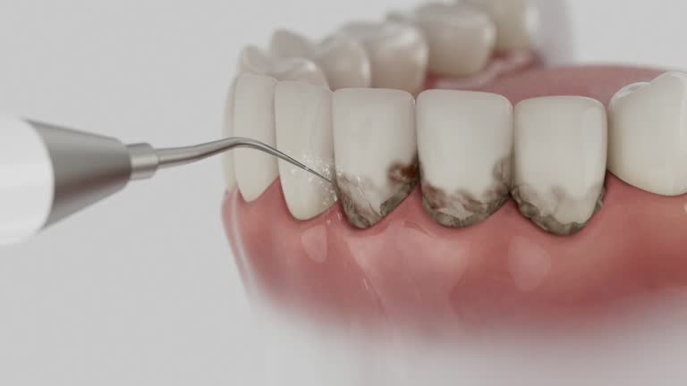 Trusted Teeth Cleaning And Checkup service in Lake Marcel-Stillwater, WA - Dentist Open Now